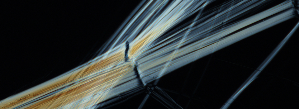 Fiber and Dust Characterization